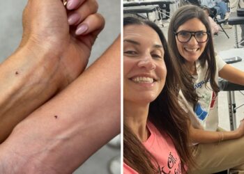 Why My Micro Fine-Line Tattoo Fell Off a Week After I Got It