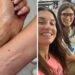 Why My Micro Fine-Line Tattoo Fell Off a Week After I Got It
